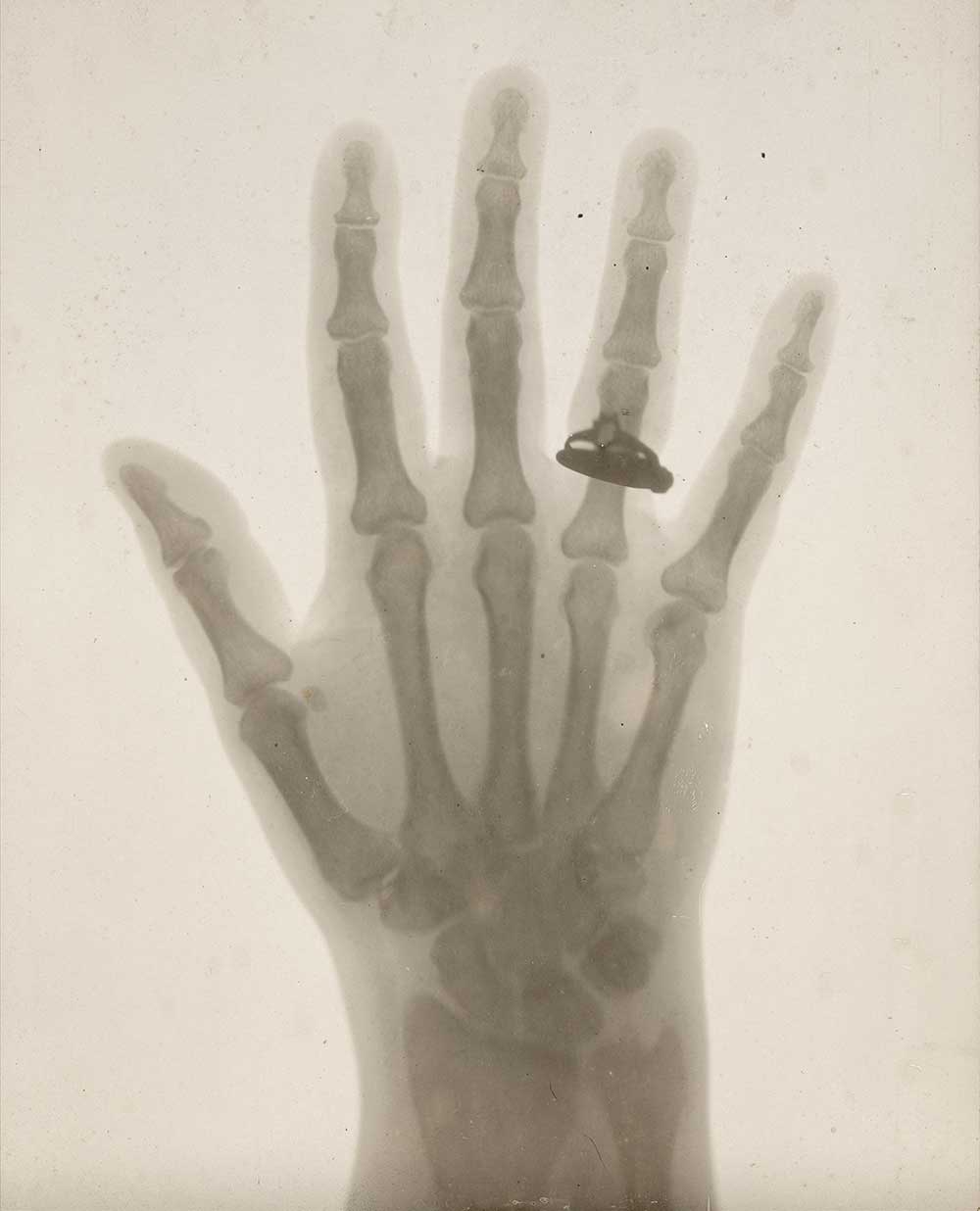 Hand X-Ray